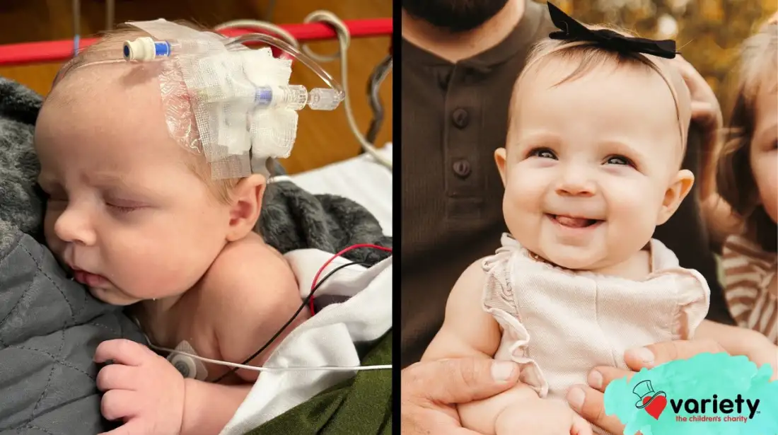 Jovie before and after