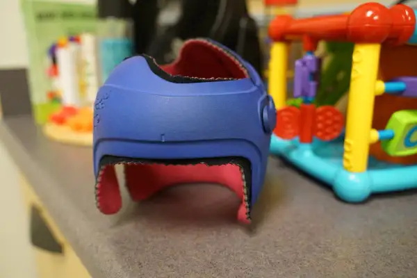 ChildServe Expands Plagiocephaly Care to Ames